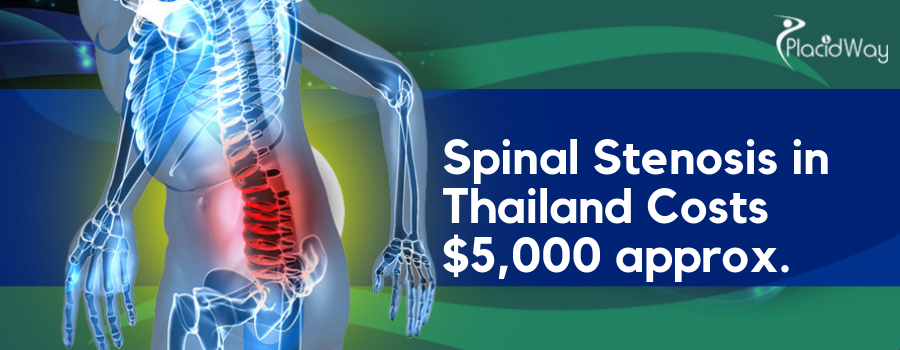 Spinal Stenosis in Thailand Cost